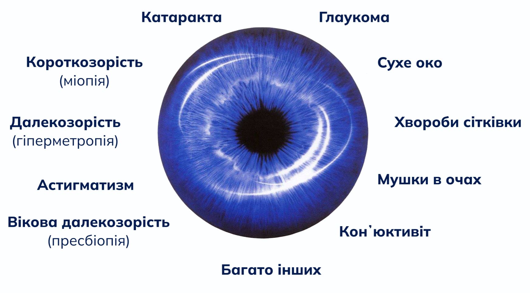Лікування без операцій та хірургічне лікування катаракти, глаукоми, сухого ока, хвороб сітківки, конʼюнктивіту, мушок в очах, короткозорості, далекозорості, астигматизму, пресбіопії